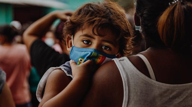 Campak Bisa Picu Pneumonia, Guru Besar FKUI Ungkap Risikonya