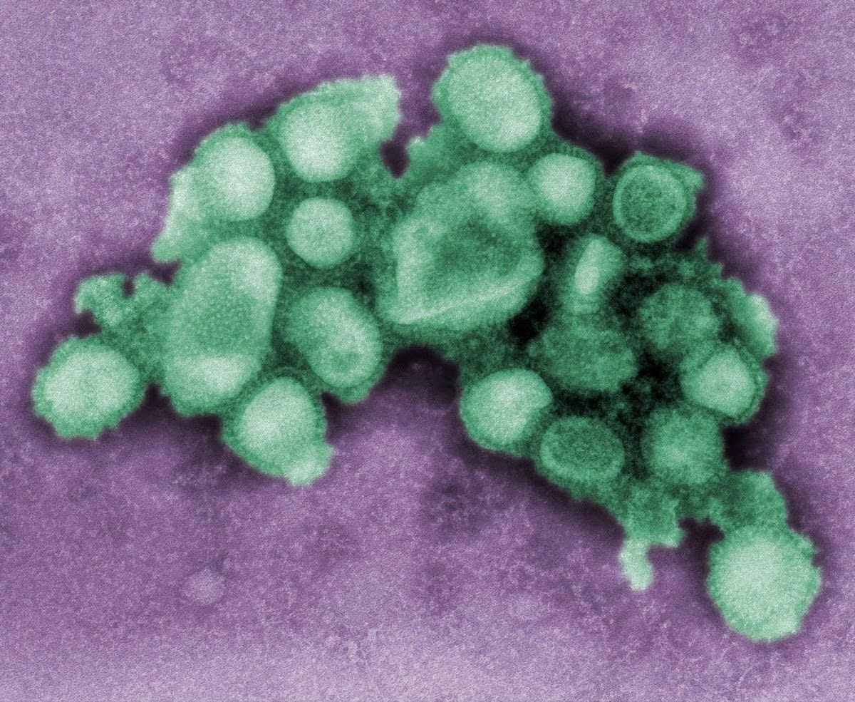 Sebaran H3N2 Subclade K di 13 Provinsi Indonesia