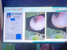 Kampus yang Ditemukan Melakukan Kecurangan SNBT 2026: Undip, Unesa, dan UPN Jatim