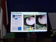 ---
Kecurangan UTBK 2026 Hari Pertama: Modifikasi Foto dan Alat Dengar Tersembunyi

---