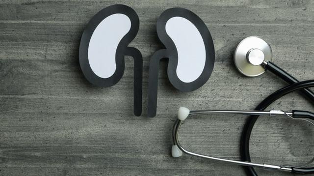 Memahami Faktor Risiko Batu Ginjal: Dari Gaya Hidup Hingga Keturunan