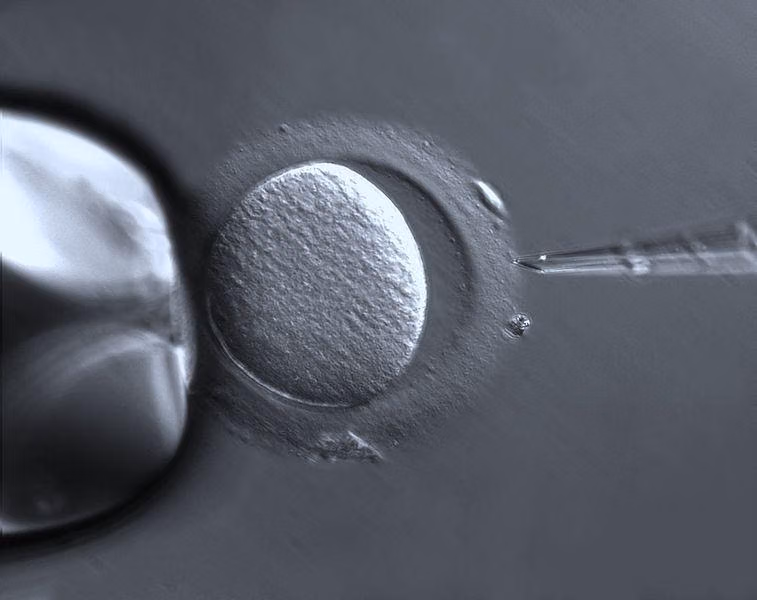 ilustrasi prosedur IVF atau bayi tabung (commons.wikimedia.org/ZEISS Microscopy)