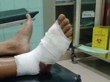 Pria di Brebes Terluka Setelah Digigit Ular Viper Saat Mengumpulkan Rumput