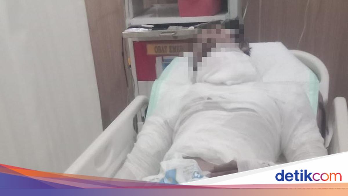 Sopir Truk Korban Pembakaran di Bali Meninggal Setelah Dirawat Seminggu