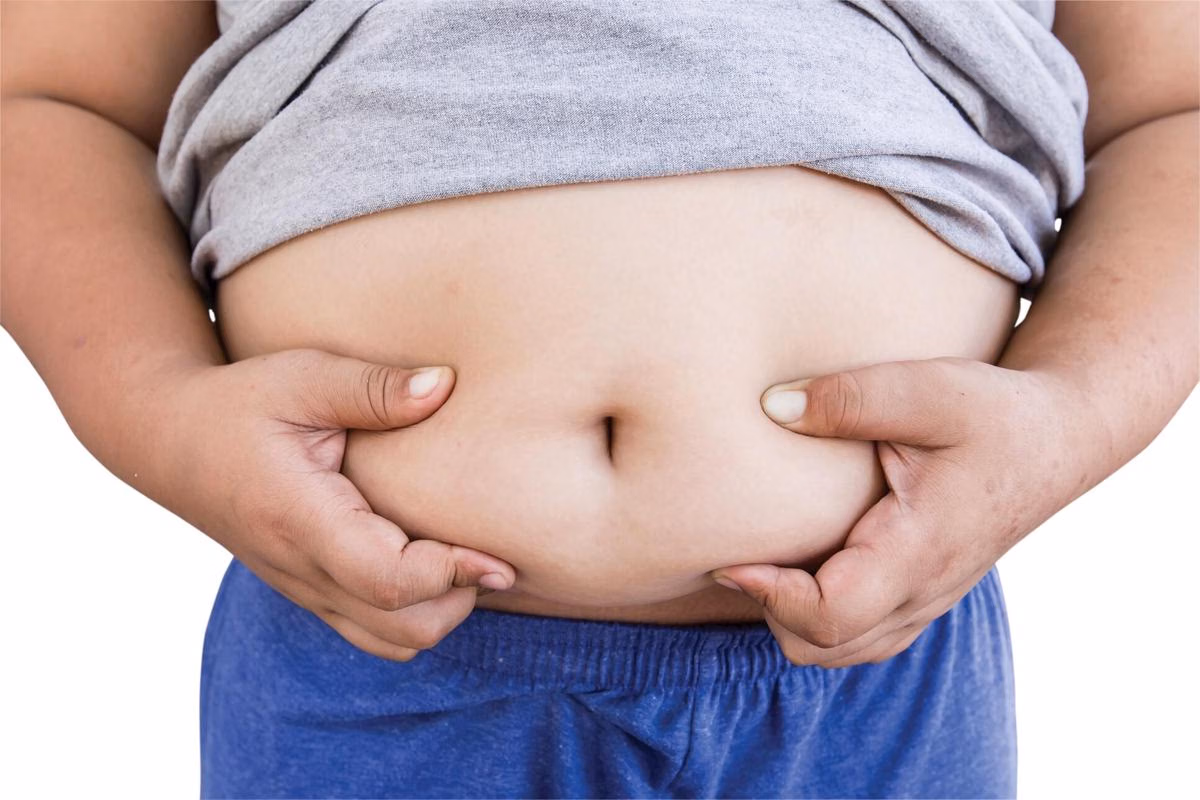 WHO Sarankan Penanganan Terpadu untuk Obesitas Anak